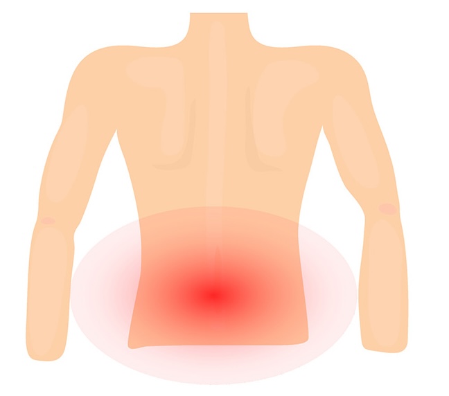 Back pain Hotspot diagram