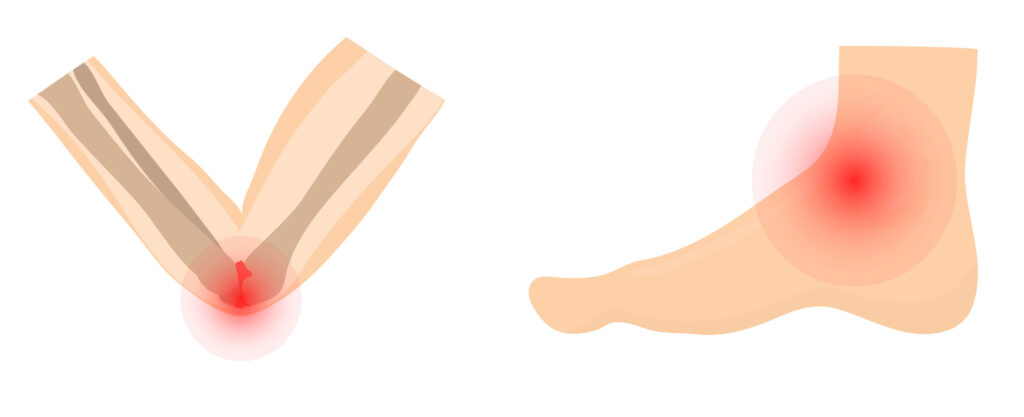 Elbow and ankle joint pain diagram
