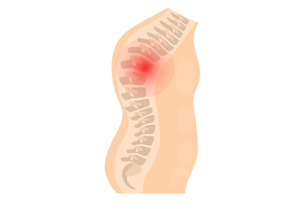 Spine joint pain diagram
