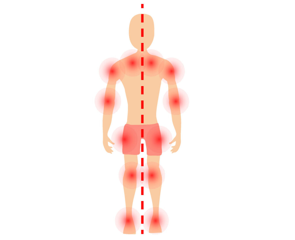 Body alignment diagram with joint pain hotspots