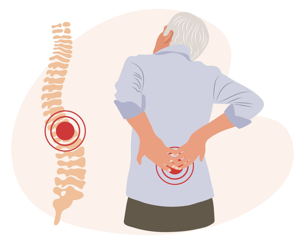 Man in pain from scoliosis
